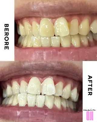 セルフホワイトニングサロン  エクシアホワイト 王寺店所属・エクシア王寺 NISHIKAWAのその他イメージ