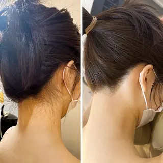 うなじ脱毛/美肌脱毛 LABELのエステ・リラクイメージ