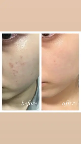 🦋美肌サロン. maho🦋のエステ・リラクイメージ