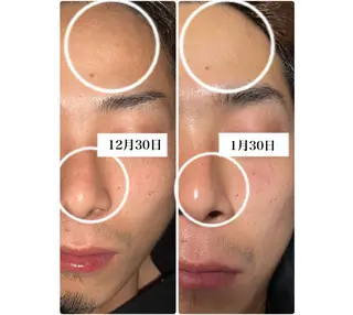 ROR Akariのエステ・リラクイメージ