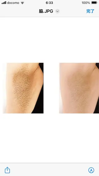 無人脱毛サロンMIRAE(ミレ)所属・無人セルフ脱毛サロン MIRAE(ミレ)のエステ・リラクイメージ