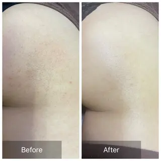 バフトアップ/ハーブ Nornのエステ・リラクイメージ