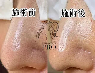 Lipula リプラ所属・毛穴ツヤ肌専門    Lipulaのエステ・リラクイメージ