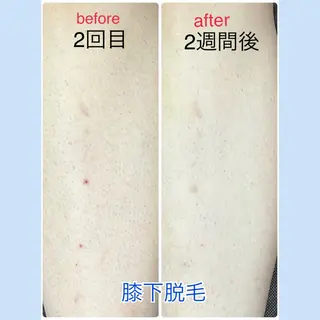 Mia.rosa所属・光フェイシャル・脱毛 MIA.ROSAの眉毛・アイブロウイメージ