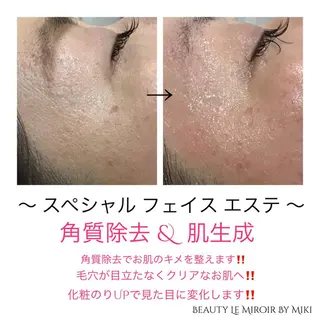 ビューティー ミロワールのエステ・リラクイメージ