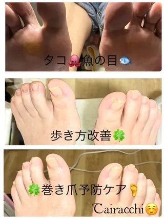 ネイル Tairacchi ﾀｲﾗｯﾁのエステ・リラクイメージ