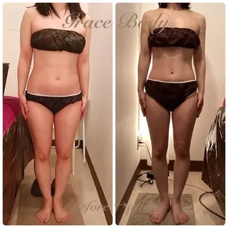 痩身・小顔・脱毛 グレイスボディのエステ・リラクイメージ