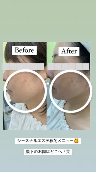 デ・アイム新潟　　北所属・山口 萌のエステ・リラクイメージ