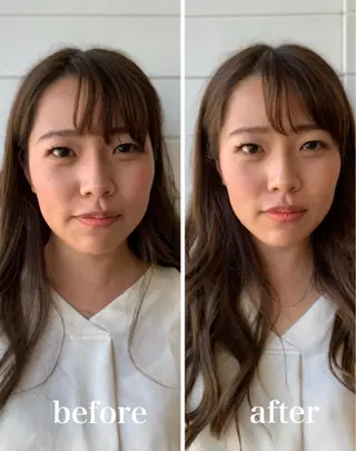 美容鍼 IKEZAKIのエステ・リラクイメージ