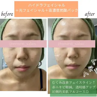 🌿emirai SEN🌿のエステ・リラクイメージ