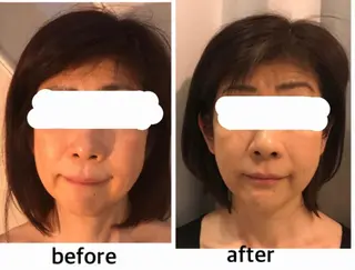 アクシア ビューティー サロン所属・究極のアンチエイ ジングサロンのエステ・リラクイメージ