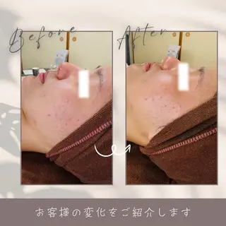 LukeBeauty salonのエステ・リラクイメージ