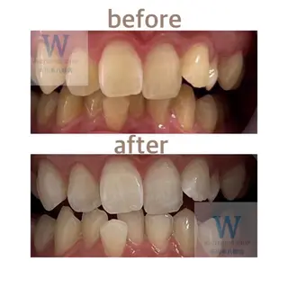 ホワイトニング ショップ本八幡店のエステ・リラクイメージ