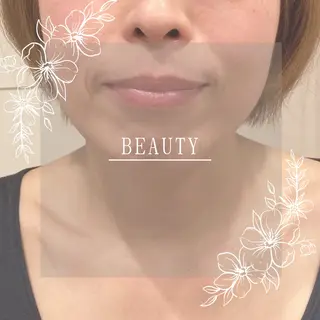 小顔×肌質改善サロン soin〔ソワン〕のエステ・リラクイメージ