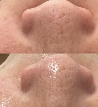 Beauty   Salon  Adiy所属・Adiy ikumiのエステ・リラクイメージ