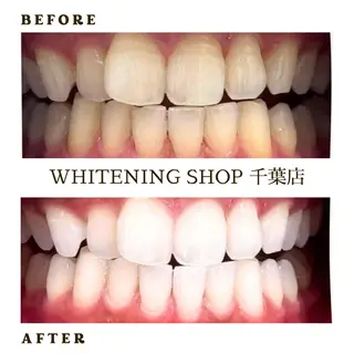 メンズ ホワイトニング ショップ千葉店のその他イメージ