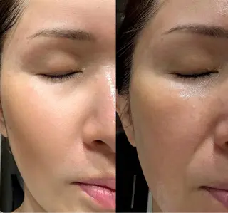 mire（ミレ） トータルビューティーのエステ・リラクイメージ