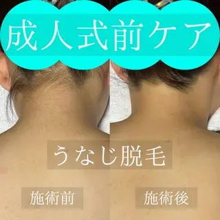 エステサロン　WABISABI所属・【美肌・脱毛専門店】 博多WABISABIのエステ・リラクイメージ