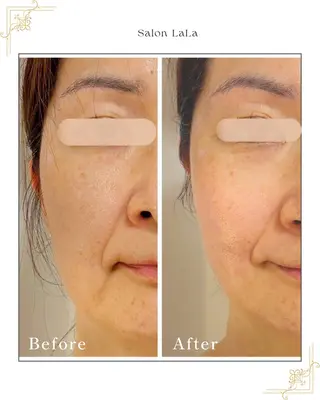 LaLa所属・小顔・たるみケア 専門店【&LaLa】のエステ・リラクイメージ