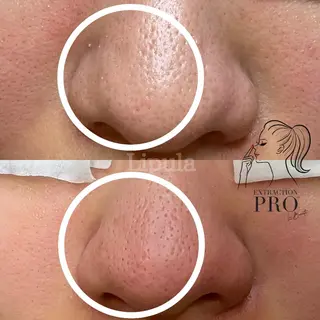 Lipula リプラ所属・毛穴ツヤ肌専門    Lipulaのエステ・リラクイメージ