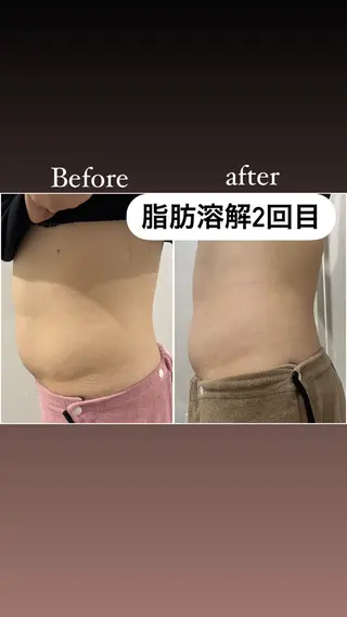 毛穴洗浄・痩身・脱毛 /アルカンジュのエステ・リラクイメージ