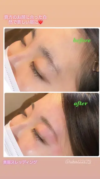 アイブロウ ハーブピーリング/韓国肌管理/フェイシャル/毛穴洗浄/眉毛/顔脱毛【糸脱毛専門】rev所属・ハーブピーリング🌹 毛穴洗浄❤️眉waxのエステ・リラクイメージ