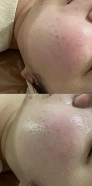 エステfreep takamoriのエステ・リラクイメージ