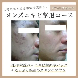 コガオファクトリー 北24条店のエステ・リラクイメージ