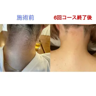 中尾 朱里のエステ・リラクイメージ