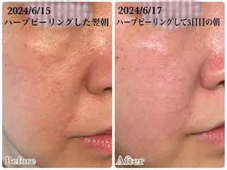 リンパケアサロン 🧡Relairのエステ・リラクイメージ