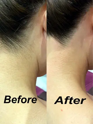 ラヴァコケット あべの店のエステ・リラクイメージ