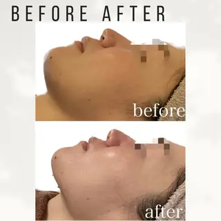 Beauty salon ハピー所属・大人女性のための 肌管理サロン　ハピーのエステ・リラクイメージ