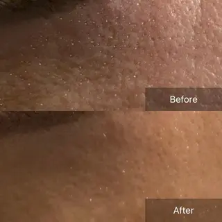 Mandarin Orange所属・毛穴から始める肌メン テマンダリンオレンジのエステ・リラクイメージ