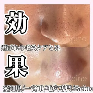 Reine BeautySalon所属・毛穴/シミ肝斑/脱毛 横山梨里のエステ・リラクイメージ