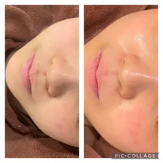 セミロング カラー パーマ ヘアアレンジ メンズ キッズ ネイル マツエク・マツパ アイブロウ ニキビ特化型エステ 🍓最短で肌質改善のエステ・リラクイメージ