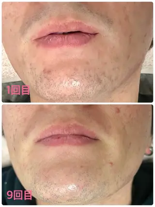 メンズ Mens Salon SOLEのエステ・リラクイメージ