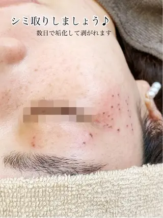 Ailes トータルビューティーのエステ・リラクイメージ