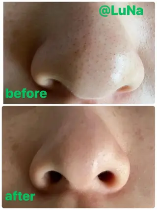 リラクゼーション ルナのエステ・リラクイメージ