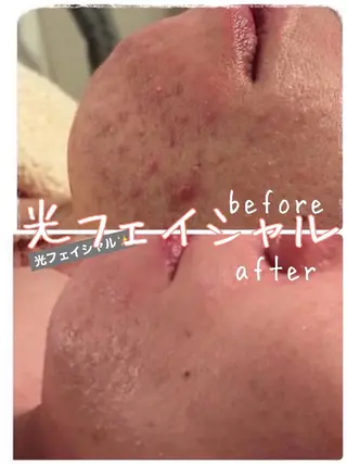 エステsala藤沢 sanaeのエステ・リラクイメージ