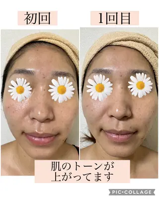 美肌専門salon クオレのエステ・リラクイメージ