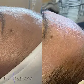 amu nail. RINAのネイルデザイン