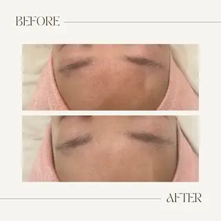 CEsalonEgg 齋藤のエステ・リラクイメージ