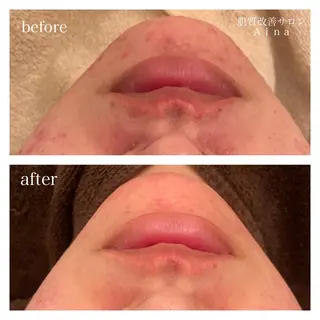 ショート カラー パーマ ヘアアレンジ メンズ キッズ ネイル マツエク・マツパ ニキビ跡専門サロン Ａｉｎａのエステ・リラクイメージ