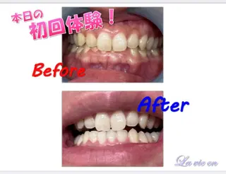 セルフホワイトニングサロン　ラヴィアン所属・ホワイトニングサロン La vie enのその他イメージ