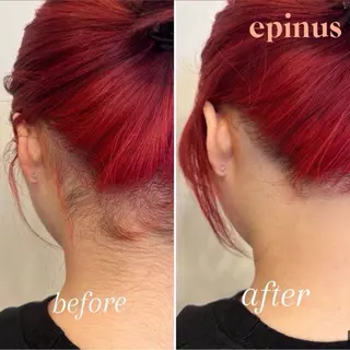 ブラジリアンワックス&美肌脱毛　エピナス大和店所属・エピナス 大和店のエステ・リラクイメージ