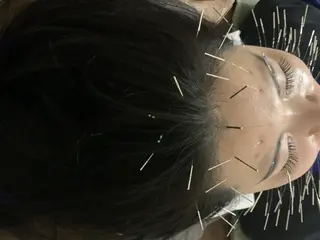 表参道鍼灸院K 美容鍼🔮ララピールのエステ・リラクイメージ