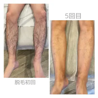 メンズ MISTO所属・MISTO Sanaのエステ・リラクイメージ