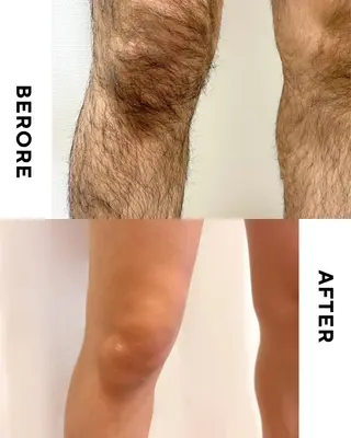 メンズ 脱毛サロン うらしまさんち所属・【脱毛サロン】 うらしまさんちのエステ・リラクイメージ