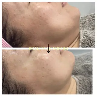 ビューティー ミロワールのエステ・リラクイメージ