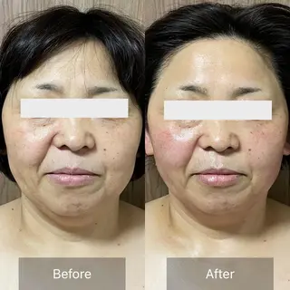 未病ケアサロン EMINY所属・未病ケアサロン EMINY☺︎勝俣のエステ・リラクイメージ